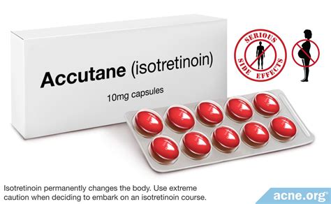 accutane isotretinoin acne oral does medication skin effects side cause long faster taking age dan term updated march last summary