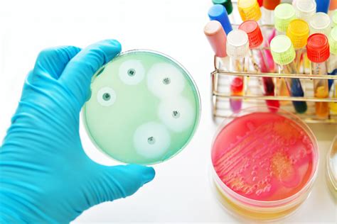 antibiotic susceptibility ast testing test