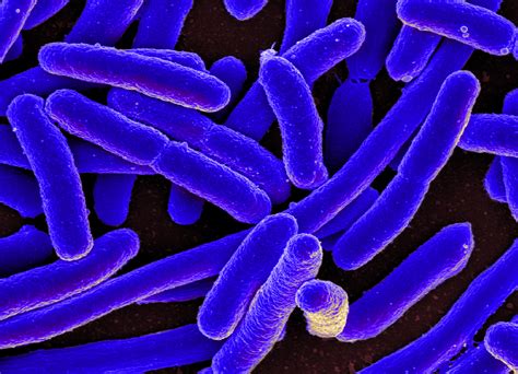 coli ecoli bacterial organisms superbugs