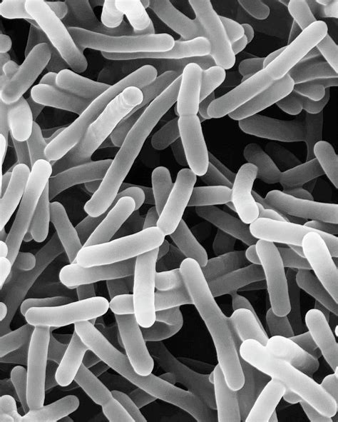 bifidobacterium animalis kunkel microscopy bacterium probiotic microscopyscience