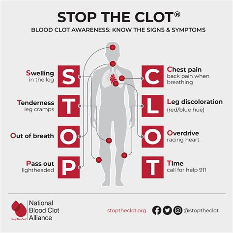 clot clots acronym dvt pulmonary lung embolism stoptheclot