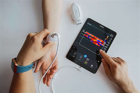 portable medical devices diagnostic diagnostics healthcare philips ultrasound vision