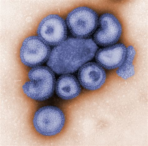 virus influenza electron micrograph viruses microbe particles