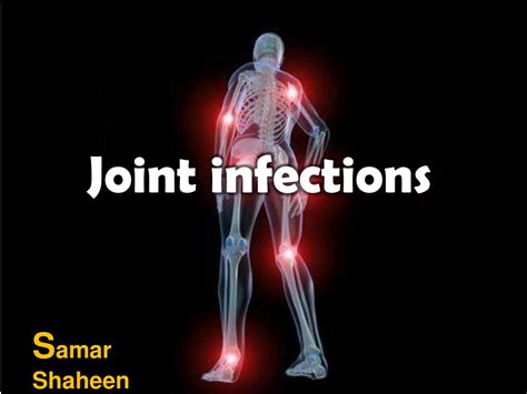 joint bone infections ppt powerpoint presentation samar shaheen