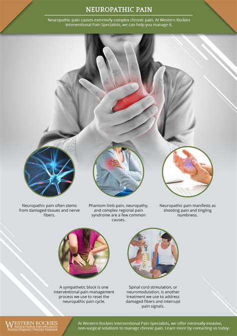 neuropathic neuralgia sympathetic