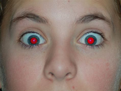 red eyes eye causes people photographs flash makes