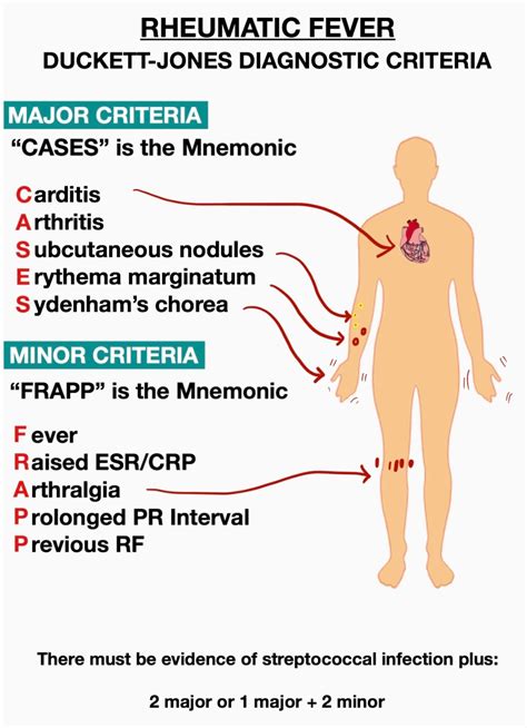 fever rheumatic criteria acute diagnostic mnemonics clinical manifestations arf aschoff junction graphical