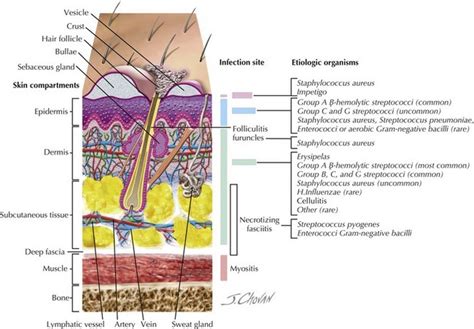 skin infections tissue layers soft section cross showing types figure
