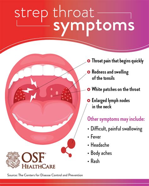 throat strep streptococcal infections oral osf beaumont