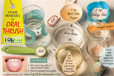 thrush oral remedies adults cure infection yeast candidiasis mouth natural top10homeremedies candida top throat symptoms known holistic use hundred peep