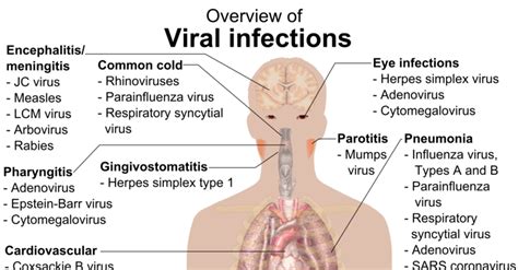 viral infections overview chart