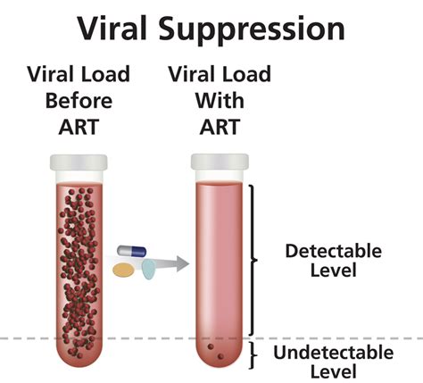 hiv viral suppression glossary
