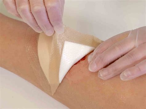 dressing wound change dressings skin old peel removal remove healing water use hold starting edge away top do