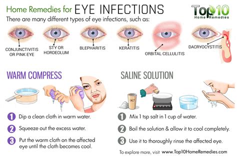 eye infection infections remedies remedy symptoms top10homeremedies pink natural baby gif treatment eyes types rid allergies eyelids adults allergy reduce