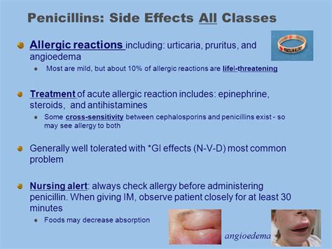 effects side penicillins antibiotic antiinfectivemeds