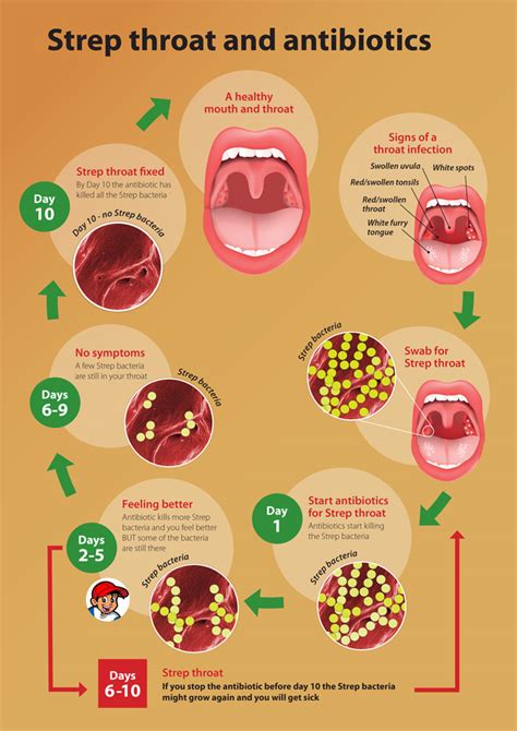 antibiotics throat strep sore infection cure health nz fever early rid flowchart treatment symptoms cough stages signs care mouth starts