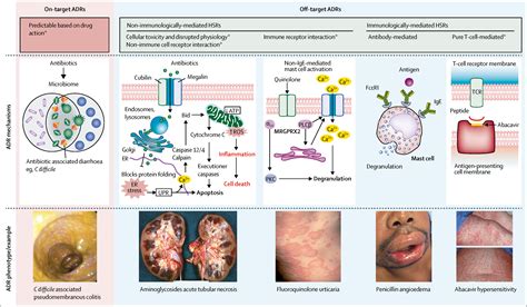 allergy antibiotic lancet pdf jbs