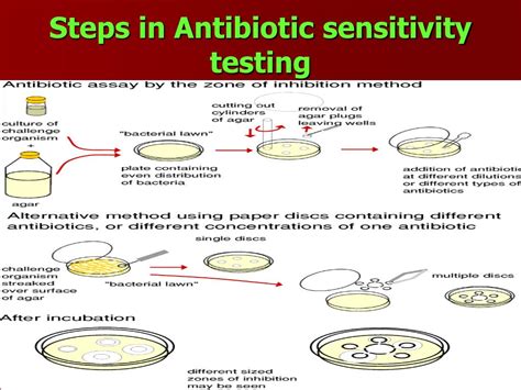sensitivity antibiotic testing steps susceptibility ppt diffusion inhibition zone