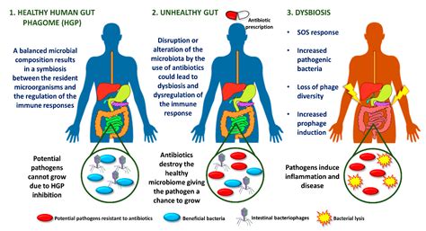 phage dysbiosis gastrointestinal associated intestinal diseases antibiotic microorganisms
